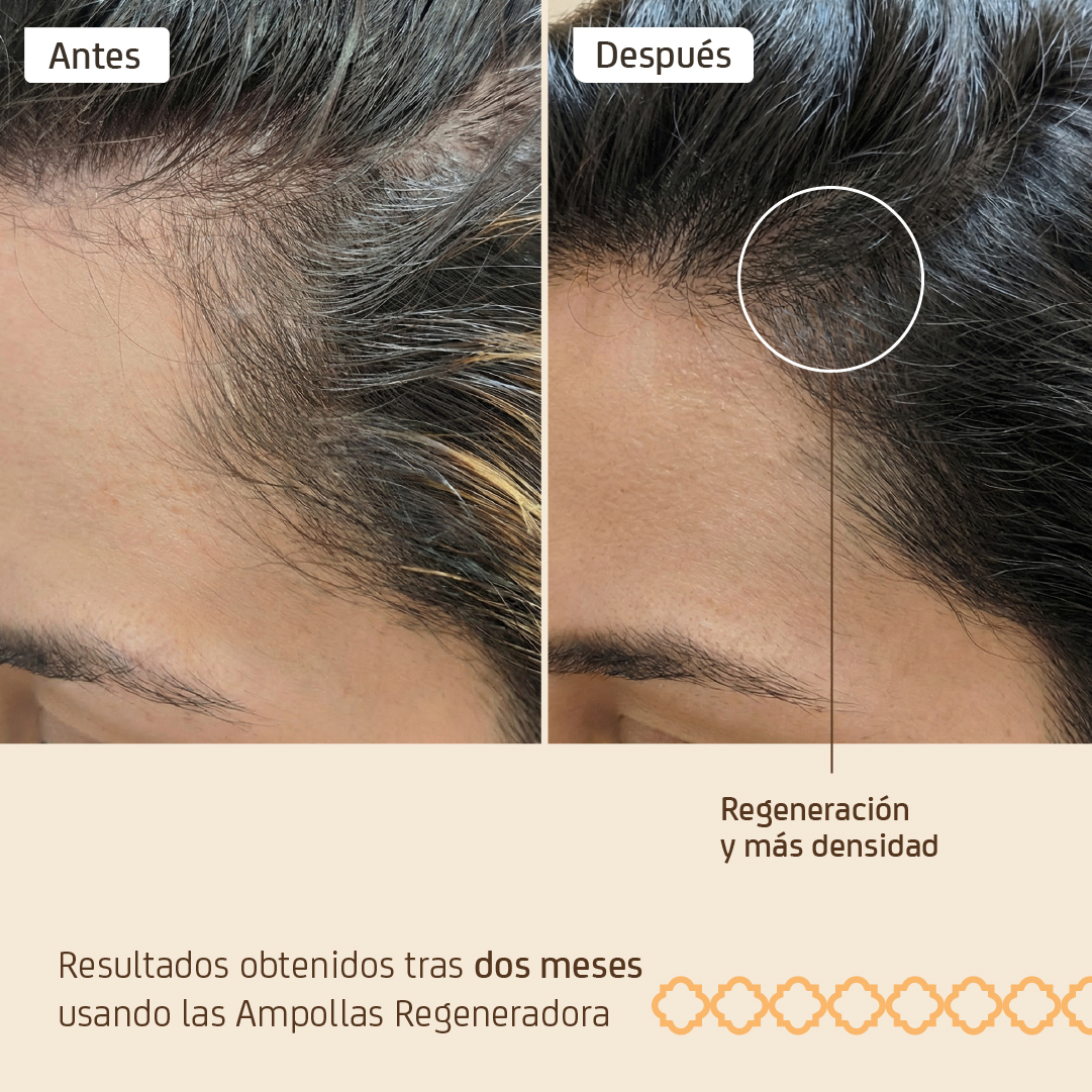 Ampolleta Regenerador Capilar - Imagen 3