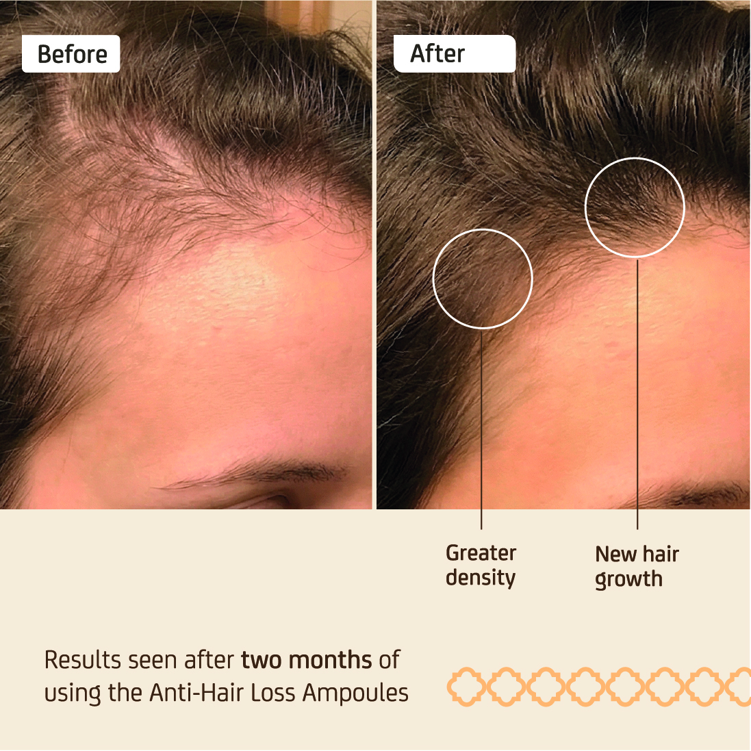 Effective Anti-Hair Loss Ampoules - Image 3