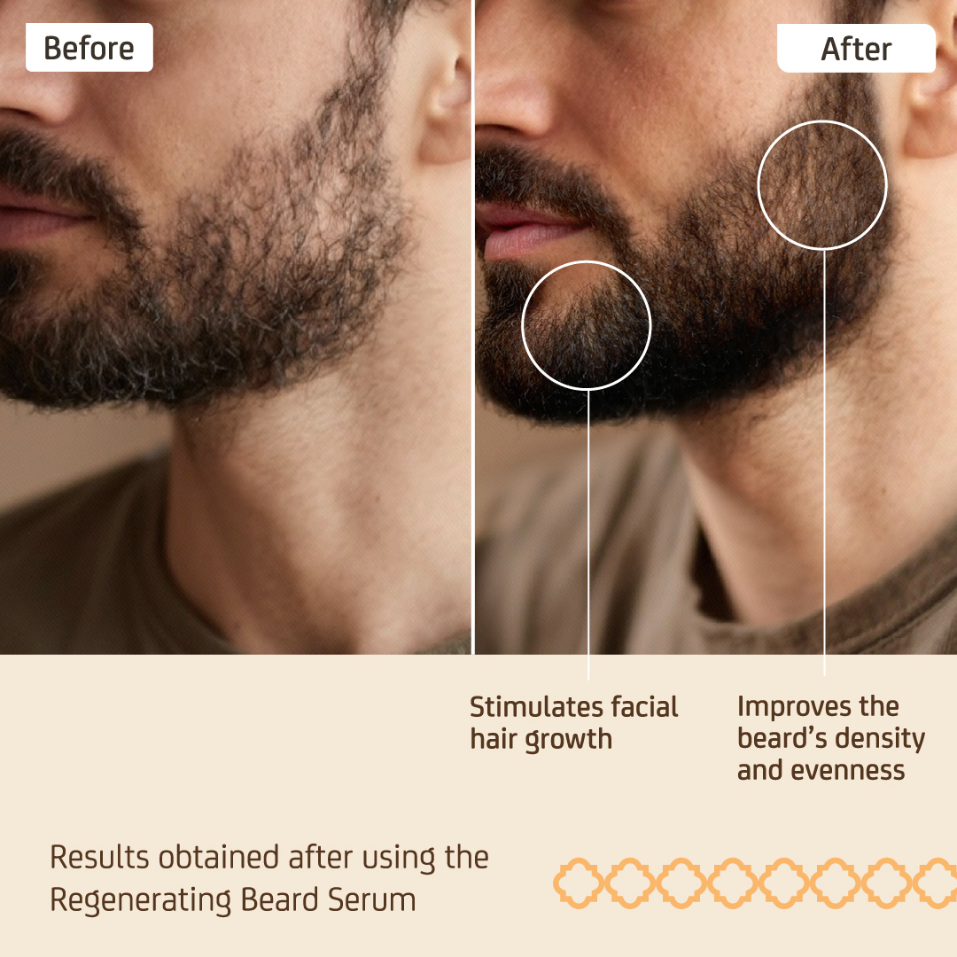 Regenerating Beard Serum - Image 3
